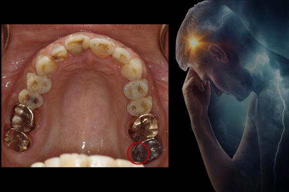 imaging of a patient's mouth